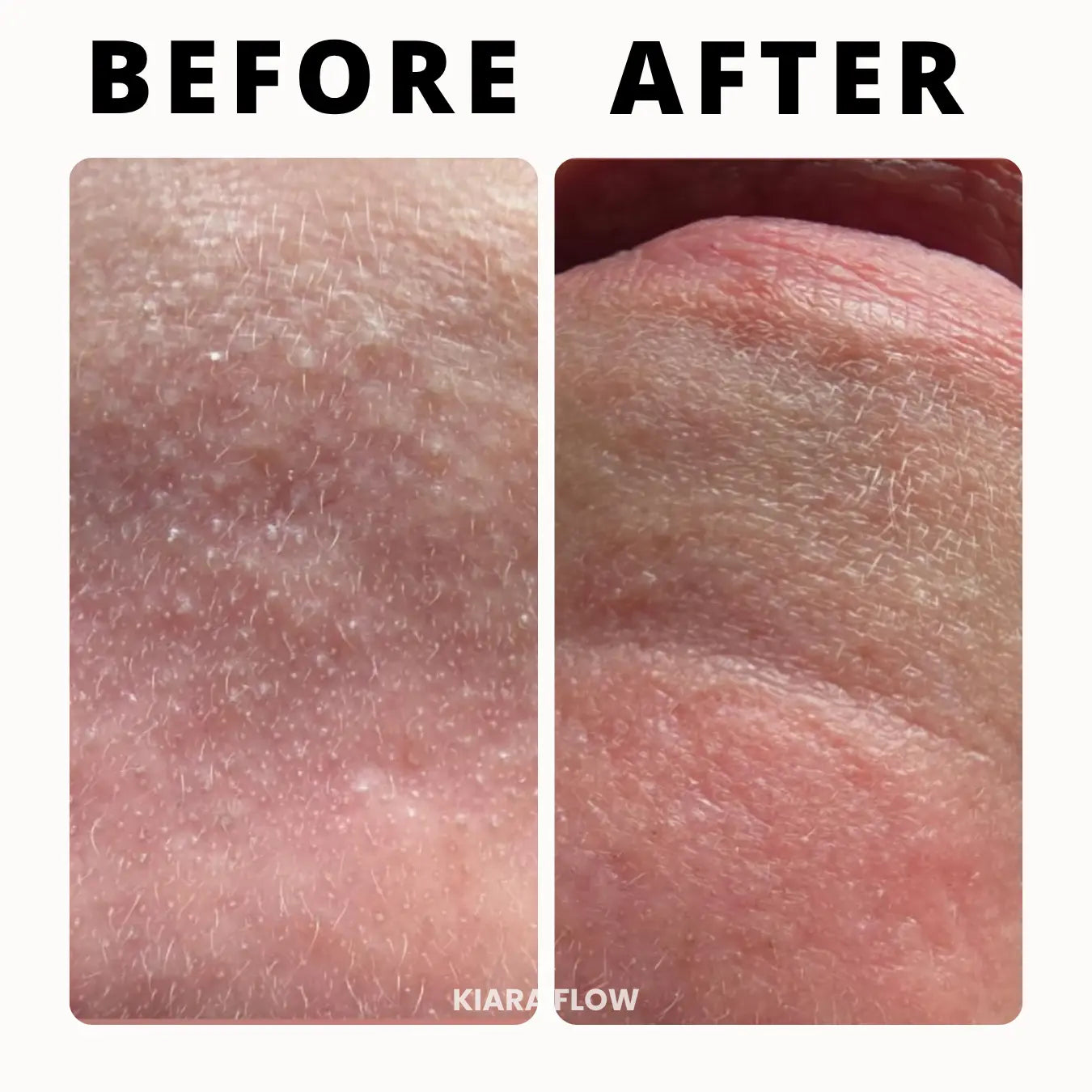 KIARA FLOW RiceShot™ Duo Exfoliator